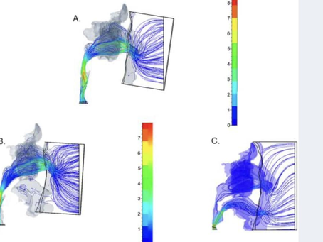 睡安智SNOSA在口呼吸、口鼻呼吸與口呼吸在睡眠障礙的效果