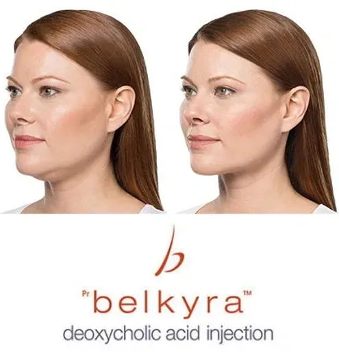 belkyra_edited.jpg
