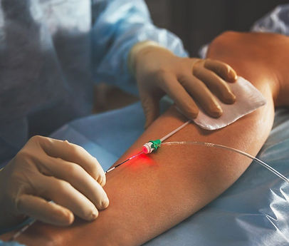 Operacion-Varices-Laser-1024x1024 (1).jpg