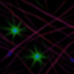 Fluorescence microscopy image showing multiple astrocytes with bright green branching processes and blue-stained nuclei on a black background.