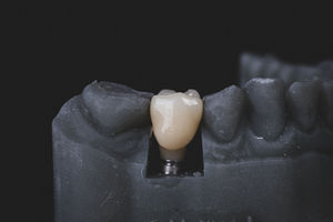 Strona 3Dimplant