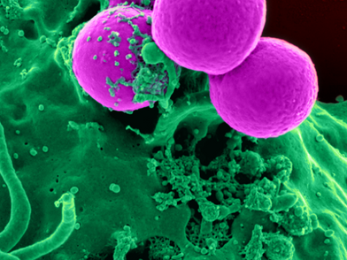 Superbugs