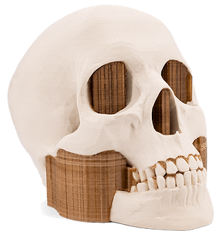 Bone simulation.png