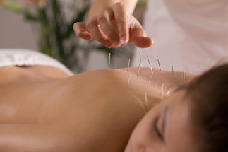Acupuncture-For-Back-Sciatica.jpg