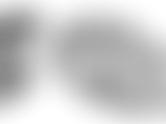 ¿Cómo seleccionar una lámpara quirúrgica excelente?