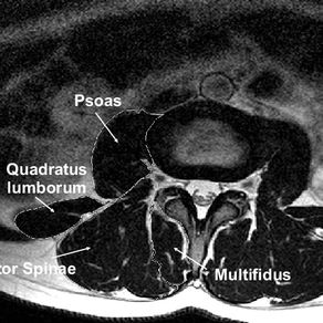 IMAT, stress cronico e oltre…