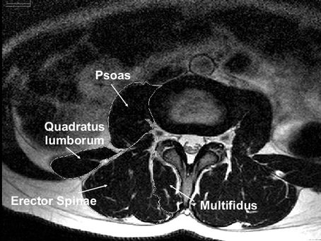 IMAT, stress cronico e oltre…