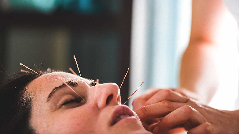 5840-_Woman_Facial_Acupuncture-1296x728-header.jpg