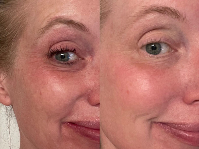 PLMIQ_Eyes-1-e1773322682585.jpg