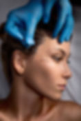 VIOLA Threads. PDO Thread treatment on the upper cheeks