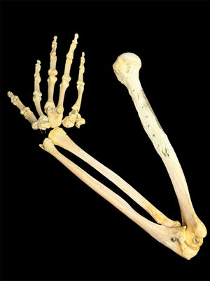 Arm with surgical plate