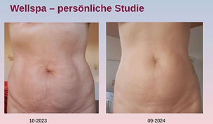Bye-Bye Cellulite 02