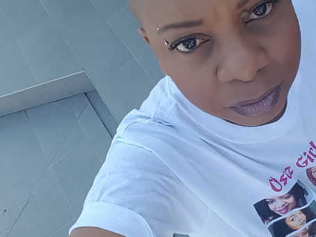 My tooth fell out over dinner