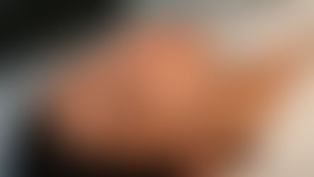 What Is a HydraFacial? Benefits, Results & Why It’s Worth the Hype