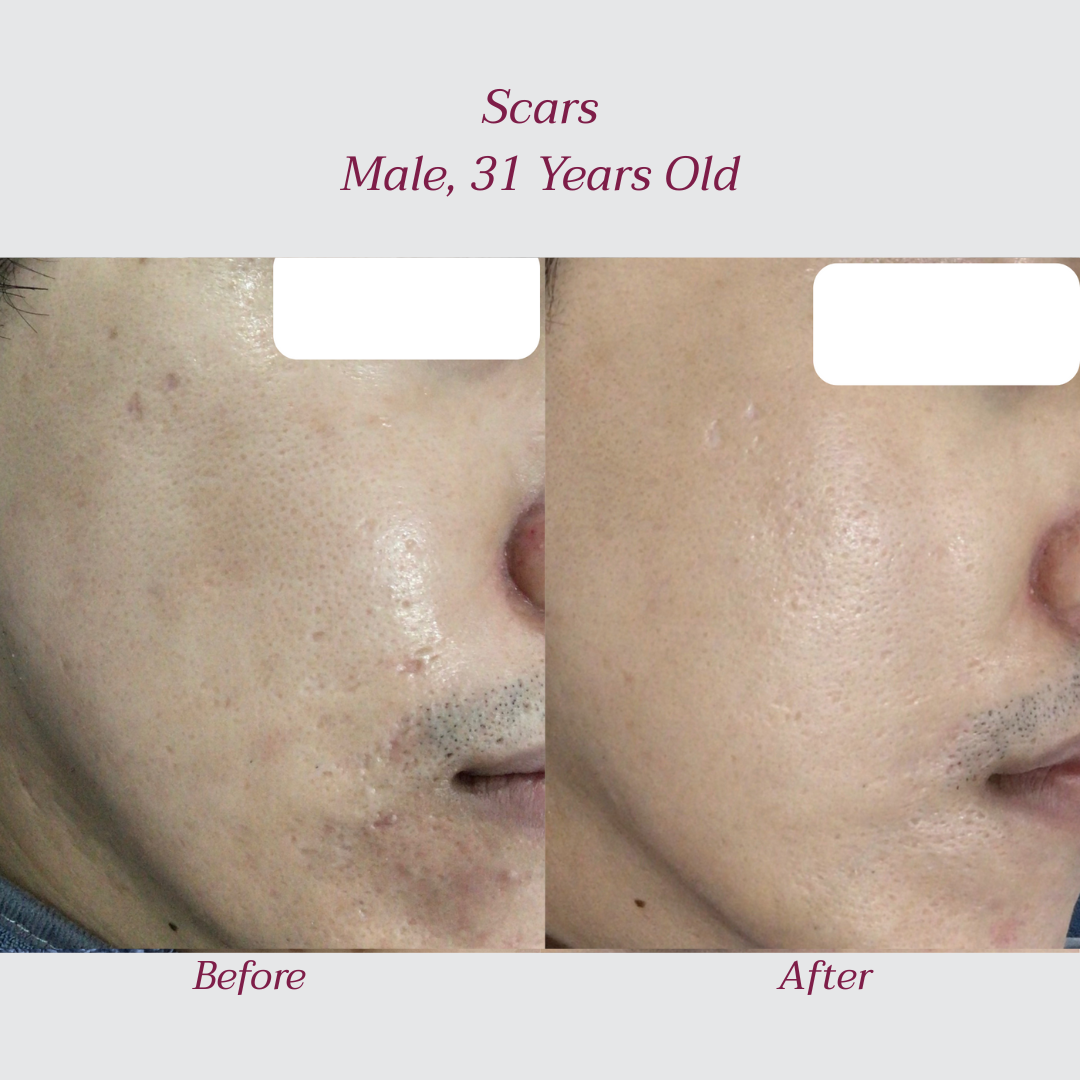 Reglo_Scars2.png