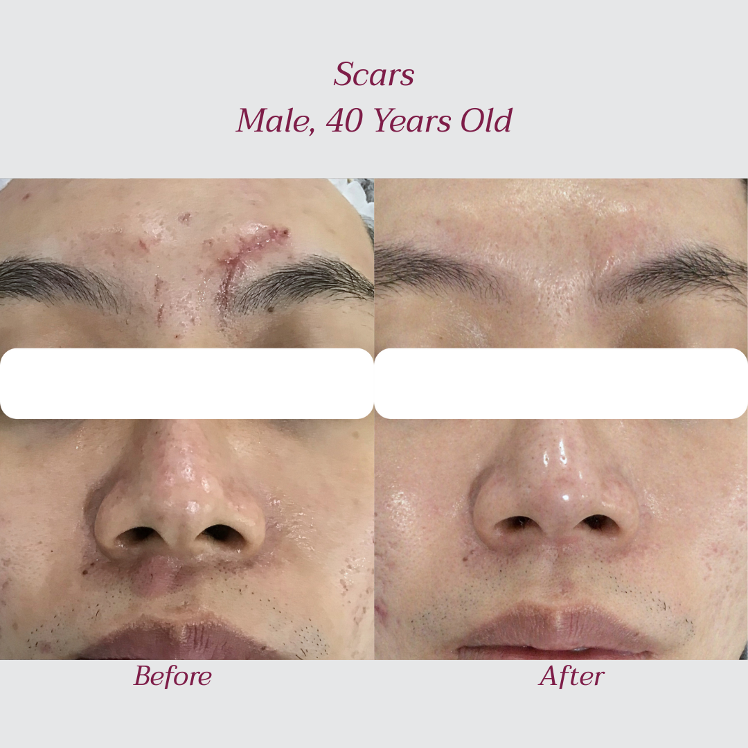 Reglo_Scars3.png