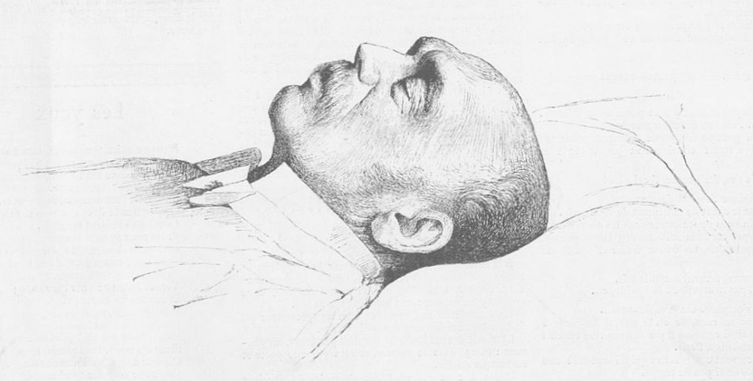 M.J.F. Portaels, directeur de l’Académie des Beaux-Arts à Bruxelles, sur son lit de mort. (Dessin de M. Jef Leempoels, son élève)