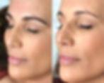 Facetune_05-08-2024-10-02-45_edited