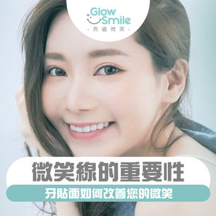 微笑線的重要性:牙貼面如何改善您的微笑