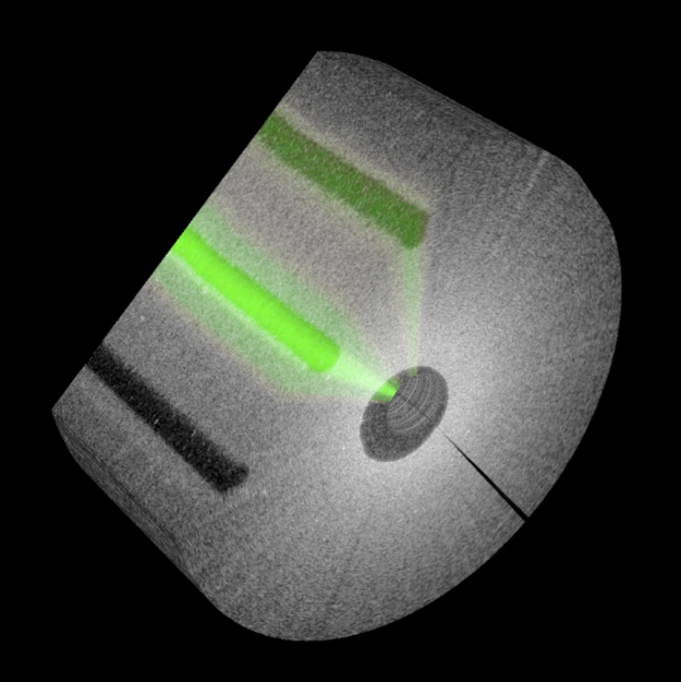 OCT & fluorescence imaging