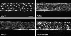 Bill presents at RARE Drug Symposium
