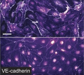 Collaboration with Kutys lab published