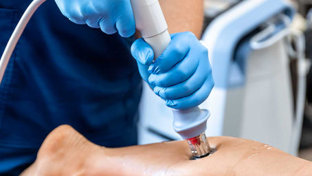 Discovering the Benefits of Shockwave Therapy in Treating Chronic Tendinopathy