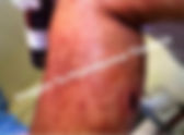 Un herido de bala deja asalto en Xaloztoc