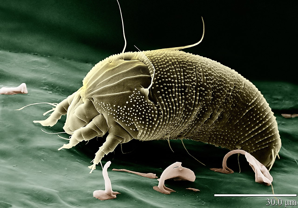 https://tr.wikipedia.org/wiki/Akarlar#/media/Dosya:Rust_Mite,_Aceria_anthocoptes.jpg