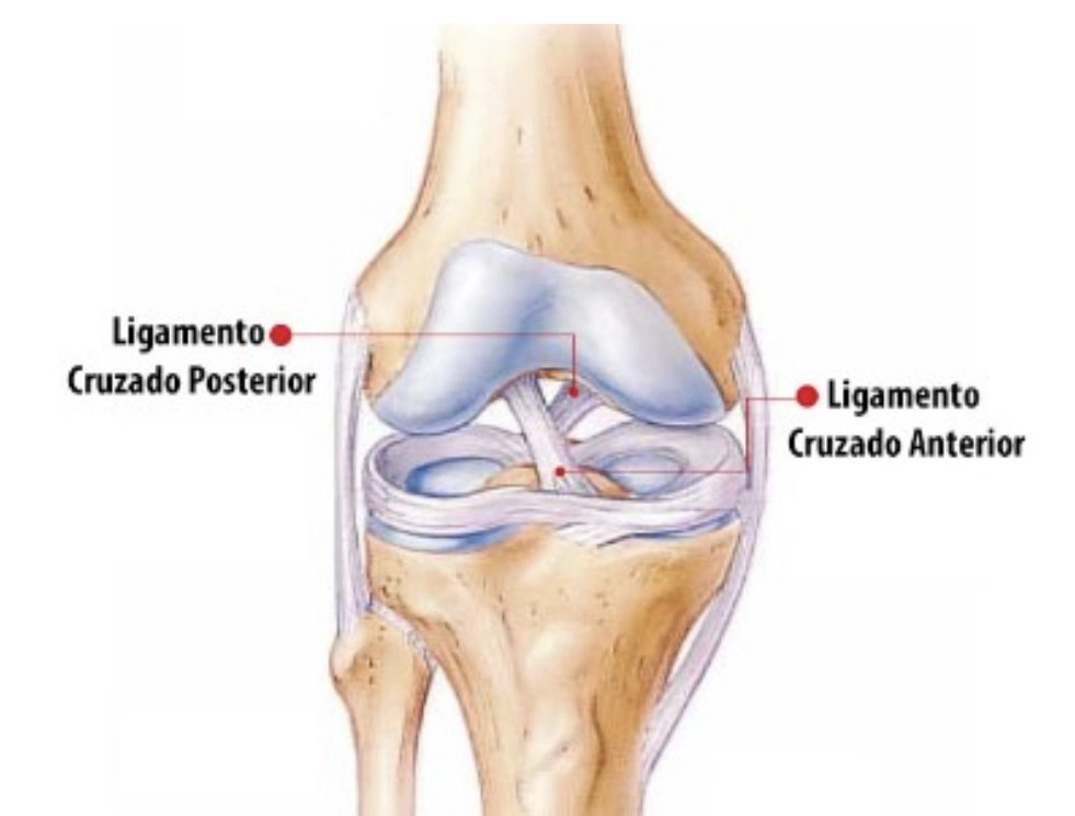 Todo sobre el Ligamento Cruzado Anterior (#LCA): causas, tratamiento y recuperación para una rodilla saludable. #SaludDeportiva #LesiónKnee