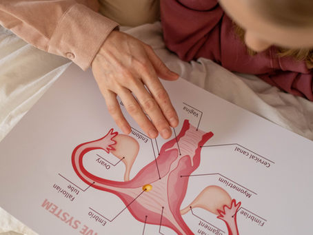 Understanding Endometriosis