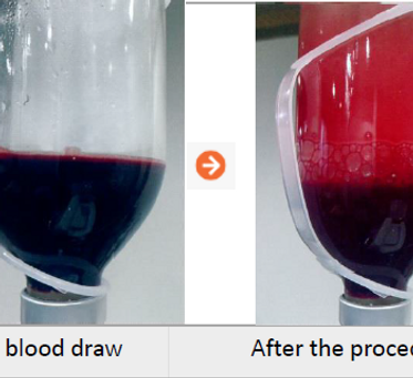 blood purification1 .png