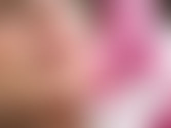 Chin Fillers: A Non-Surgical Approach to Facial Contouring in Morton