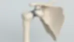 Shoulder Replacement