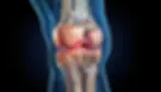 Partial Knee Replacements