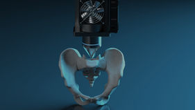 Impresión 3D para hospitales