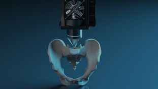 Impresión 3D para hospitales