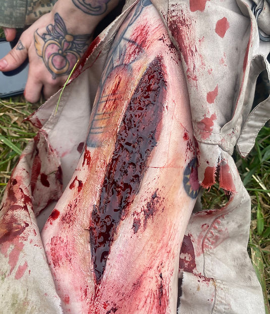 Giant gash laceration on leg 