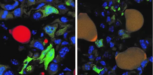 Cancer Cells Transformed into Harmless Fat in Mouse Study 