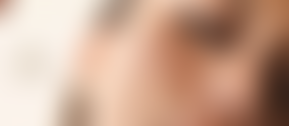 Woman applying skincare serum with a dropper on her cheek. Logo in corner reads "CHA AESTHETICS." Neutral background, close-up view.