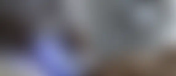 Person using a gray cellulite treatment machine on a patient's leg in a clinical setting, with a glowing blue display. Calm atmosphere.