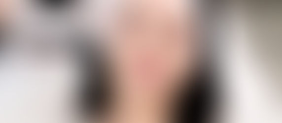 Woman with dark hair receives a facial treatment with a device, smiling slightly. Wears a white headband, gloved hands visible. Relaxed setting.