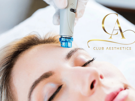 Aesthetic treatment on woman's forehead with blue device, serene expression. Logo "Club Aesthetics" in gold on white background.