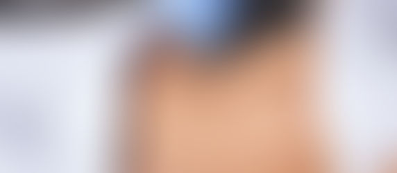 Close-up of a woman's midsection with white grid lines on skin, wearing a white bra and panties, set against a light blue background.