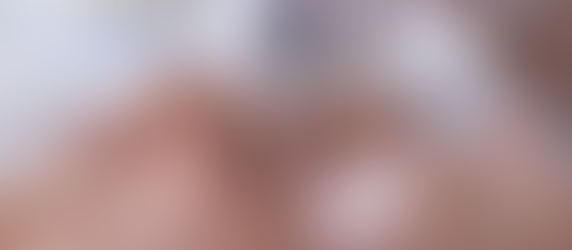 Esthetician performs microneedling on a woman with closed eyes. She wears a white headband. Logo "Club Aesthetics" in gold above.