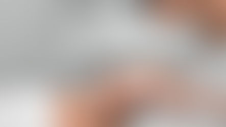 Laser CO₂ w medycynie estetycznej – złoty standard czy technologia wymagająca redefinicji?