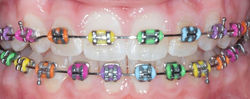 rainbow-braces-colors-1024x408