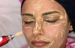 Bellaire's Top Spa for Skin Health