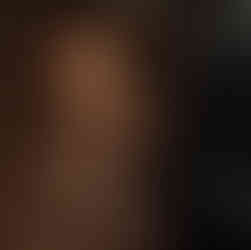 Jornada gratuita de pesquisa de glaucoma realizada en IDEO durante la Semana Mundial del Glaucoma en Maracaibo