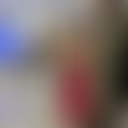 tratamiento para ojo seco en Maracaibo en la clínica ideo